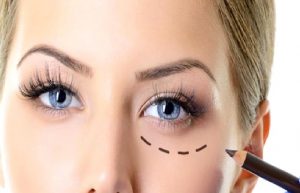 GÖZ ÇEVRESİ ESTETİĞİ İLE GÖZLERİN GÖRÜNÜMÜNÜ DEĞİŞTİRMEK MÜMKÜN MÜ?