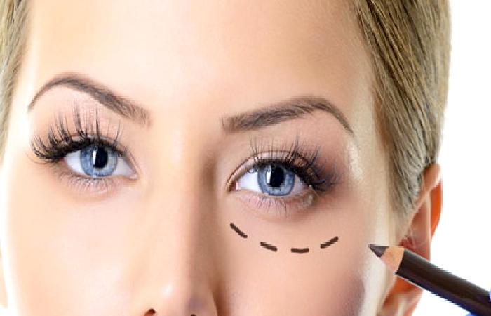 GÖZ ÇEVRESİ ESTETİĞİ İLE GÖZLERİN GÖRÜNÜMÜNÜ DEĞİŞTİRMEK MÜMKÜN MÜ?