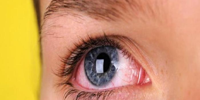 Göz İçi Tümörlerin Belirtileri Nelerdir?