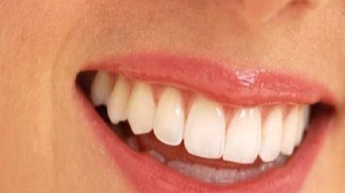 Gülümseme Tasarımı