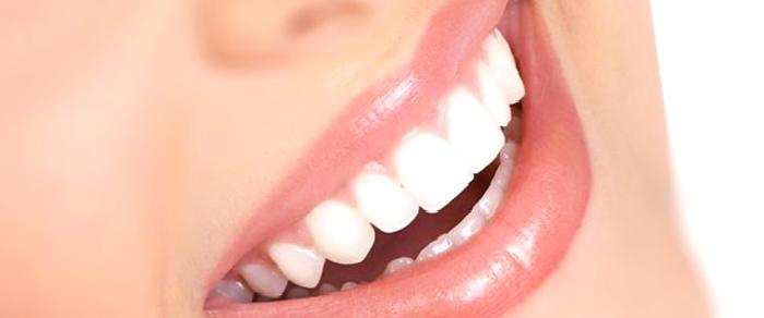 Gülüş Estetiği Nedir?Gülüş Tasarımı Nedir? Kişiye Özel Gülüş Tasarımı nasıl yapılır?