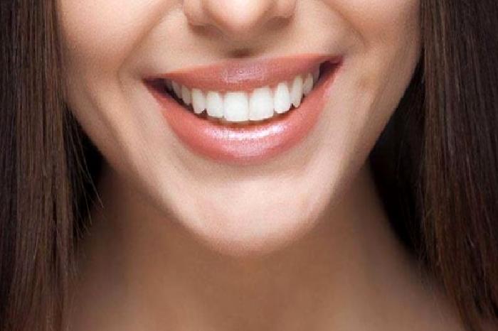 Gülüş Tasarımı Nedir?
