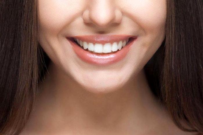 Gülüş Tasarımı Nedir?