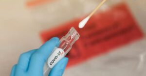 Günlük vaka sayısı 5 bin 127