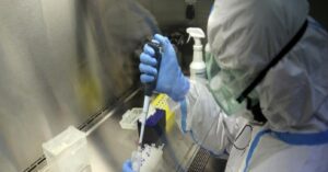 Günlük vaka sayısı 5 bin 609