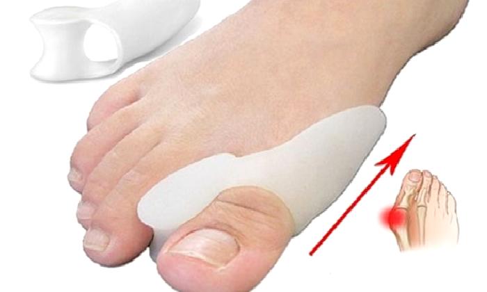 Halluks Valgus (Bunyon)