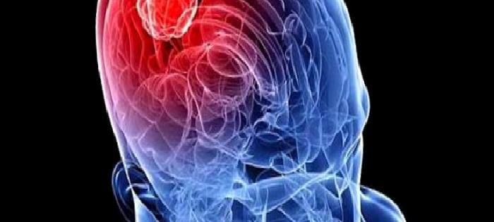 Hangi Tedavi Şekli?