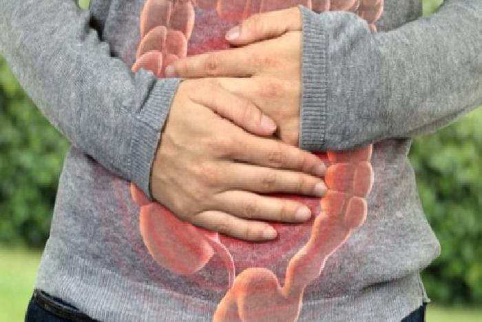 Hassas Bağırsak Sendromu