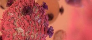 Hematolojik Kanserler