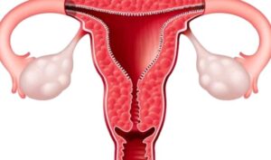 HPV Virüsü