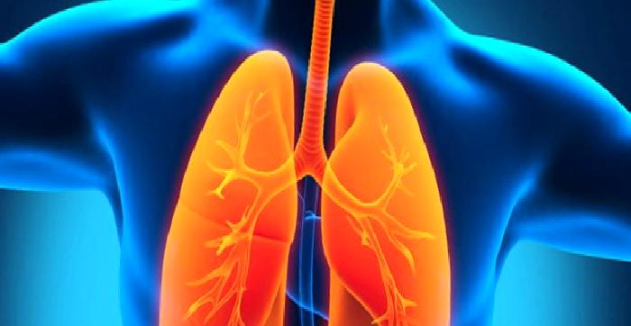 İdiopatik Pulmoner Fibrozis