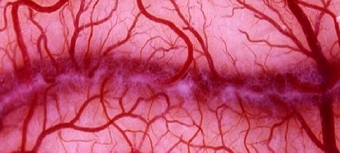 İnce Damar Hastalığı Nedir? Nasıl Tedavi Edilir?