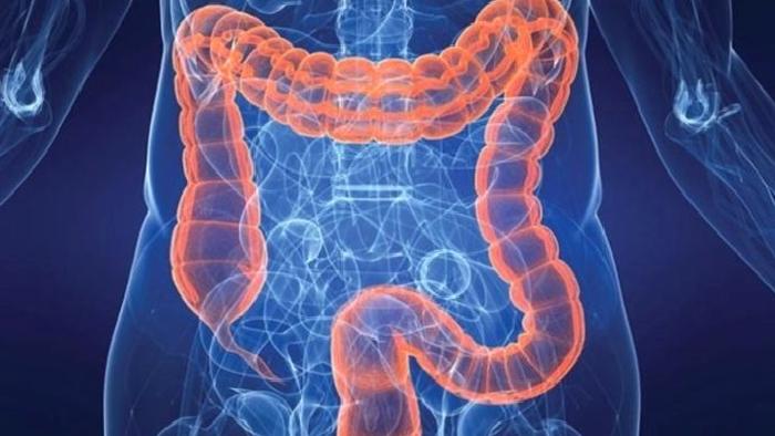 İrritabl Bağırsak Sendromu Teşhisi ve Tedavisi