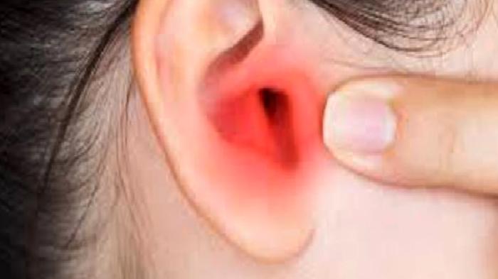 İşitme Kayıpları