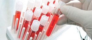 Kadınlarda Kansızlık Pıhtılaşma Bozukluğunun Habercisi Olabilir