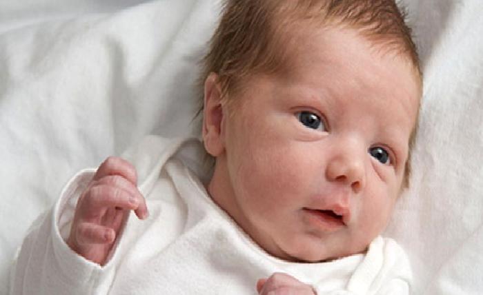 Kafatasında Şekil Bozukluğu ve Trigonosefali Nedir, Kafamın bir Kısmında Kemik Yoksa ne Yapayım?