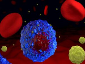 Kanser Nedir? Kanser Hakkında Genel Bilgiler