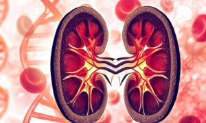 Karaciğer Kanseri: Bilmeniz Gerekenler