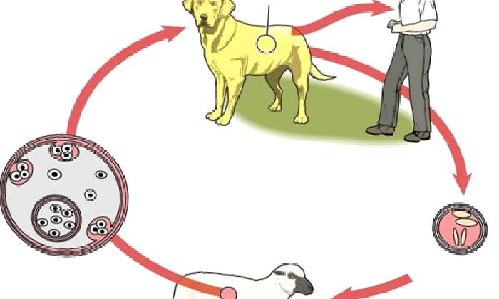 KARACİĞER KİST HİDATİĞİ VE TEDAVİ YÖNTEMİ