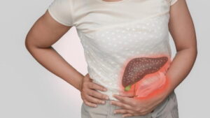 Karaciğer Yağlanmasında Beslenme Önerileri