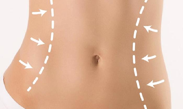 Karın ve Bel Bölgesinin Şekillendirilmesi (Karın germe ve liposuction)