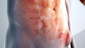 Kasık Fıtığı, İnmemiş Testis ve Sünnet