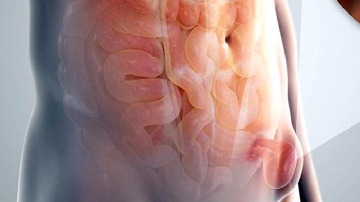 Kasık Fıtığı, İnmemiş Testis ve Sünnet