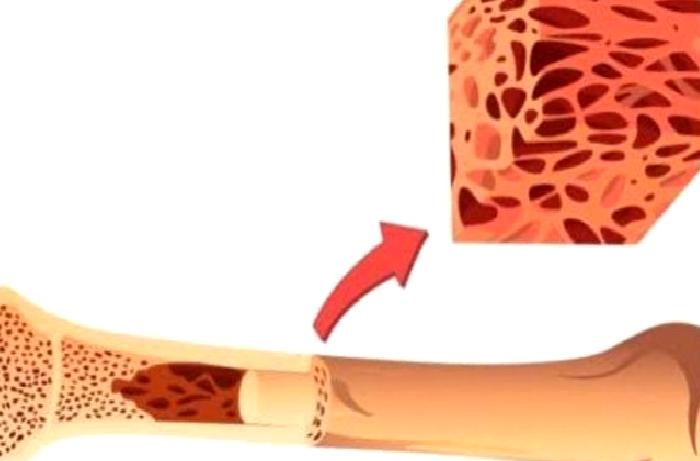 Kemiği İliği Nakli