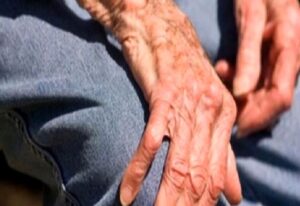 Kemik Erimesi (Osteoporoz)