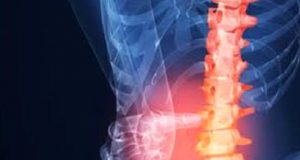 Kemik Greft ve Alternatifleri