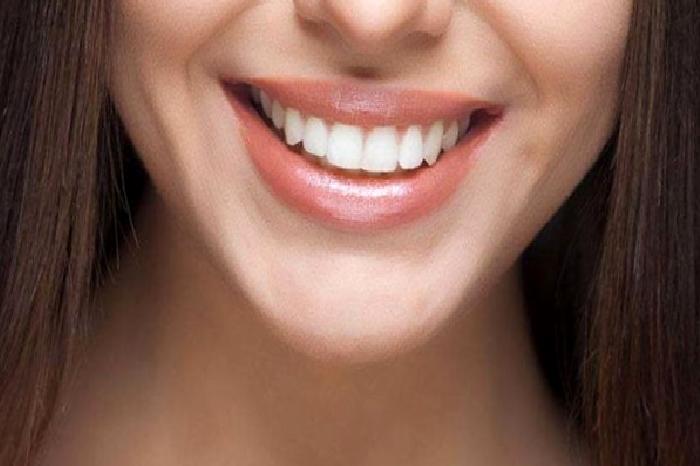 Kimler Dental İmplant Yaptırabilir?