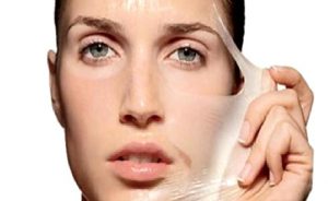 Kimyasal Peeling