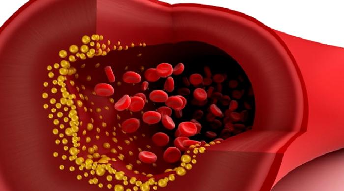 KOLESTEROL ZARARLI MI? YOKSA ZARARSIZ MIDIR?