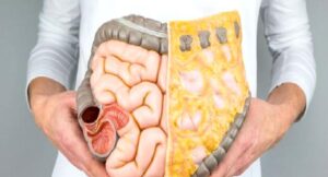 Kolon Kanseri Poliplerle Geliyor