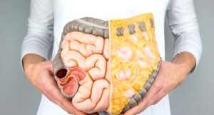 Kolon Kanserinde Erken Tanının Önemi