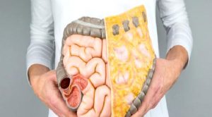 Kolon Kanserinden Korunmak İçin Nelere Dikkat Edilmeli?