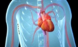 Koltuk Altı ve Meme Altı Kalp Ameliyatları