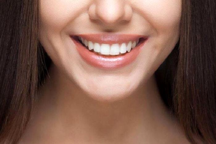 Kompozit Lamina (Estetik Dolgu) Nedir?