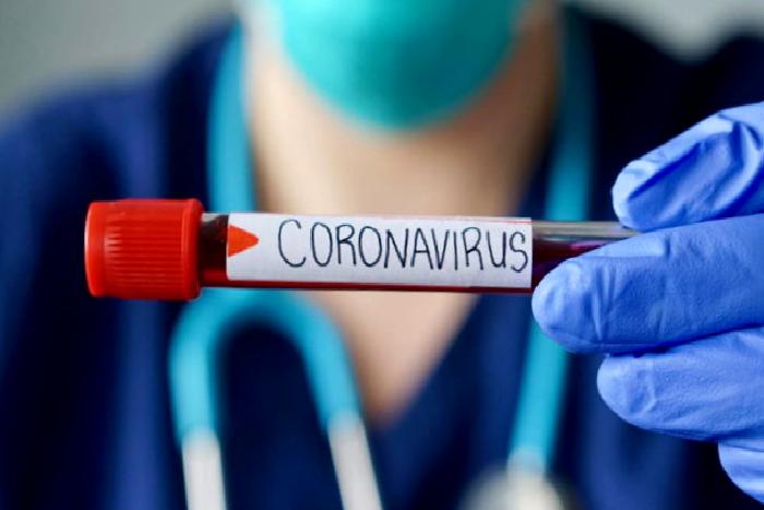 Koronavirüs Kaygısı/Anksiyetesi ile Nasıl Baş Ederiz?