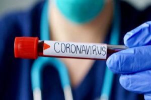 Koronavirüse Karşı Bağışıklık Güçlendirme Önerileri