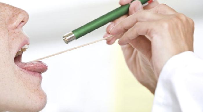 KRONİK BADEMCİK ENFEKSİYONU