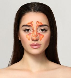 Kronik Sinüzit Tedavisi