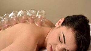 Kupa Hacamat Terapisi