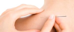 Kuru İğne Tedavisi