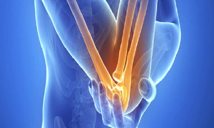 Lateral Epikondilit ( Tenisçi Dirseği) ve Fizyoterapi