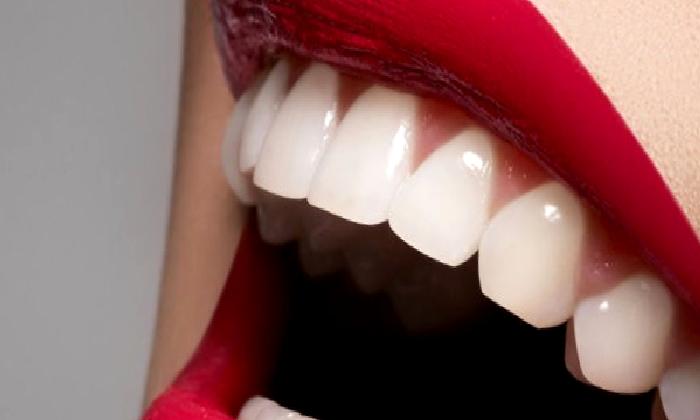 Lazer Destekli Diş Eti Peeling  (Diş Eti Beyazlatması)