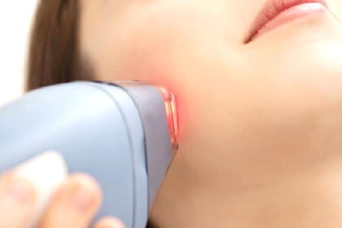 Lazer epilasyon  güvenli mi?