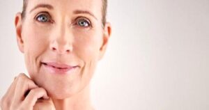 Lekeler Güzelliğinizi Gölgelemesin