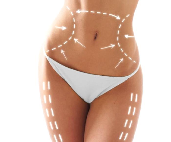 Liposuction