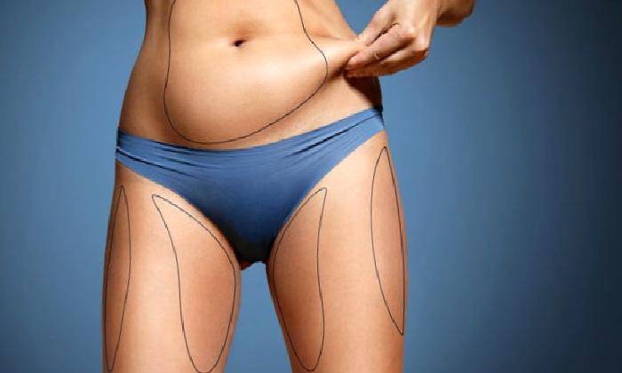 Liposuction Yöntemi İle Yağ Aldırma